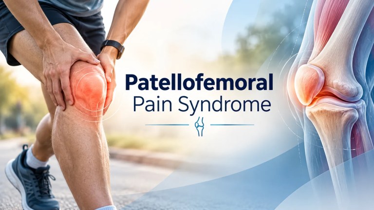 Patellofemoral Pain Syndrome (Runner's Knee): Causes, Symptoms, and Treatment
